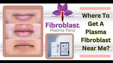 The Best Plasma Fibroblast Treatment Near You | Touch Heights