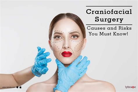 Craniofacial Surgery - Causes and Risks You Must Know! - By Dr. Ajaya Kashyap | Lybrate