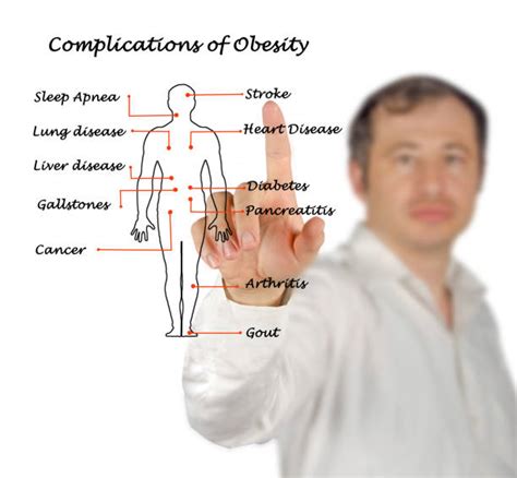 50+ Obesity Medical Complications Stock Photos, Pictures & Royalty-Free Images - iStock