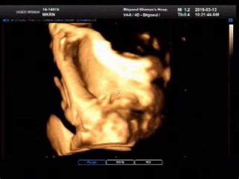 37 weeks ultrasound 3d and 4d baby boy - YouTube