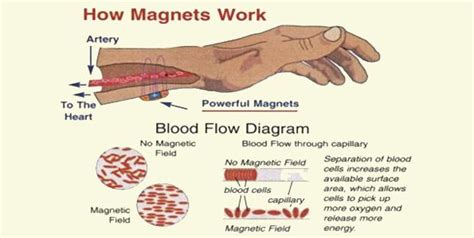 What Are The Benefits Of A Magnetic Bracelet