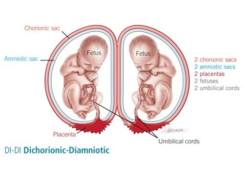 Nurse Filmed Rare Moment A Baby Was Born Inside A Fully Intact Amniotic ...