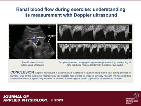 Renal Blood Flow During Exercise: Understanding Its, 58% OFF