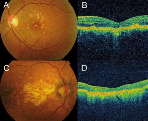 Zeiss OCT - Roswell Eye Clinic