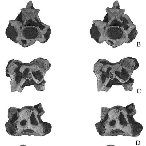 (left top). Crocodile teeth. A, lateral view of a normal tooth of ...