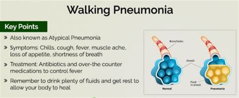 Walking Pneumonia - Symptoms, Contagious, Signs, What Is?, Treatment