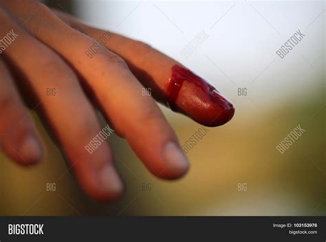 Bleeding Finger Image & Photo (Free Trial) | Bigstock