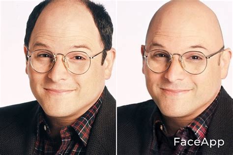 George Costanza: One of the best examples of "better bald than balding". : r/bald