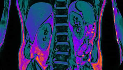 Engineers bring MRI contrast agents into better view - Futurity