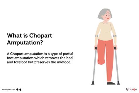 Chopart Amputation: Purpose, Procedure, Benefits and Side Effects