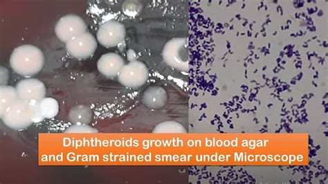 Diphtheroids growth on blood agar and Gram strained smear under Microscope - YouTube