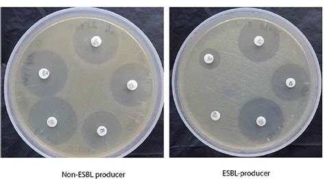 Increased Isolation of Extended-Spectrum Beta-Lactamase-Producing ...