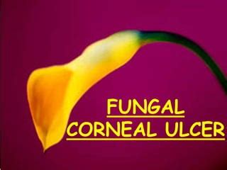 Fungal corneal ulcer | PPT