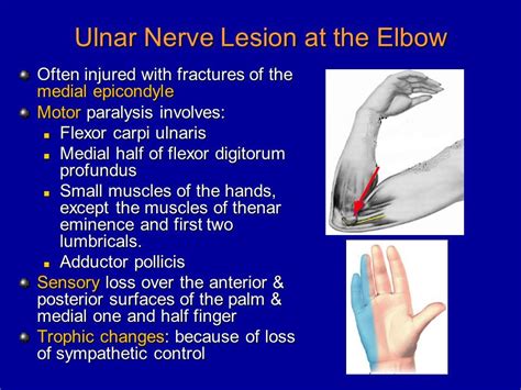 Ulnar Nerve Palsy Causes Symptoms Diagnosis Treatment Rxharun | Hot Sex ...