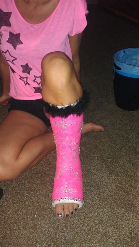 Decorated cast | Leg cast, Cast accessories, Cast decoration