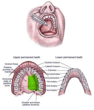 AZARSHAHRI DENTAL HYGIENE ANESTHESIA REVIEW