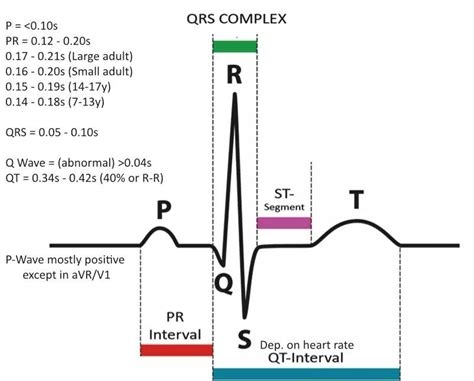 ECG interpretation | Being a nurse | Pinterest | Qrs complex and Nurse ...