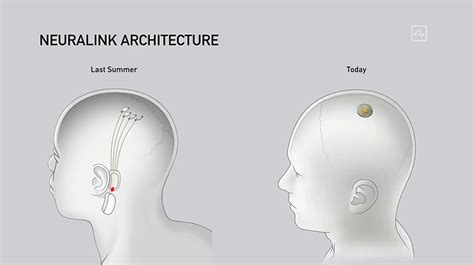 elon musk's neuralink unveils brain implant update and the surgical robot to insert it