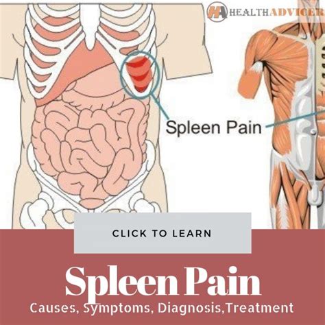 Enlarged Spleen