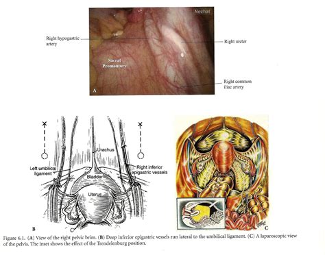 Intraperitoneal and Retroperitoneal Anatomy - Society of Laparoscopic & Robotic Surgeons