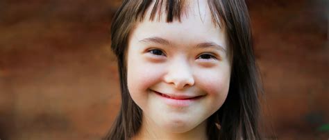 Gerber Baby Inspires Down Syndrome Abortion Bans Across The U.S. | The ...