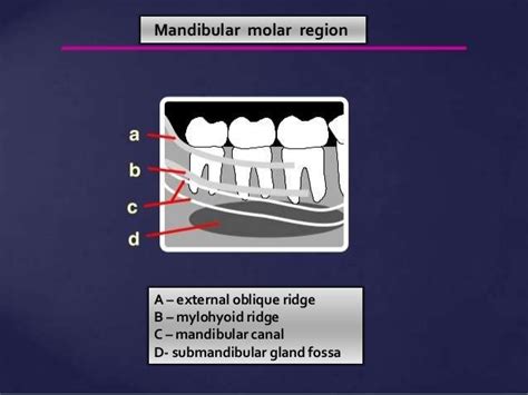 Submandibular Fossa Radiograph