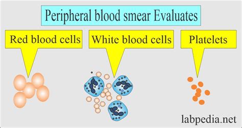 Red Blood Cell (RBC):- Part 2 - Normal Peripheral blood smear, and RBC Morphology - Labpedia.net