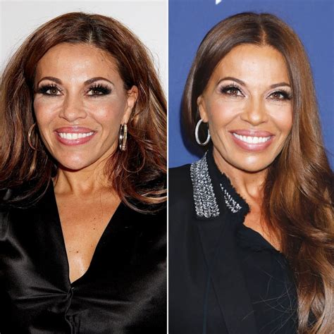 Real Housewives' Plastic Surgery: Before and After Photos