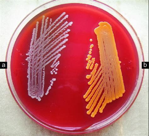 Blood agar plate showing (a) small colony variant (b) normal variant of... | Download Scientific ...