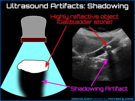 Ultrasound | Oncology Medical Physics