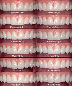 How to Choose Perfect Shaped Teeth & Veneers for Your Face