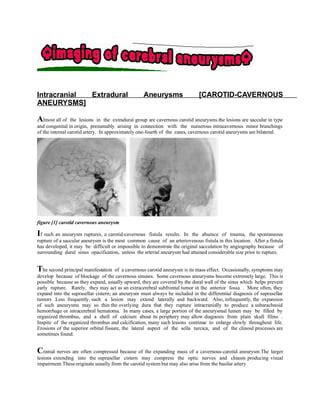 Aneurysm | PDF