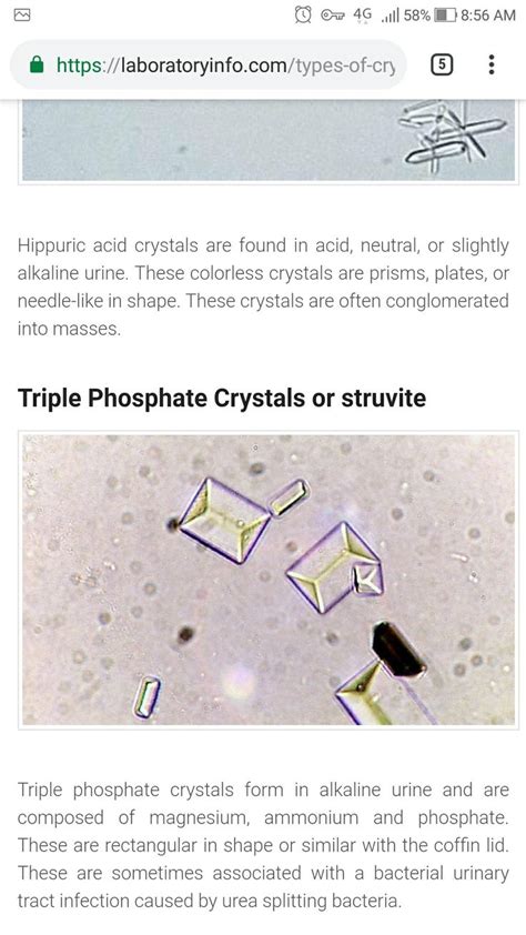 Triple phosphate | Human body systems, Microbiology lab, Medical laboratory