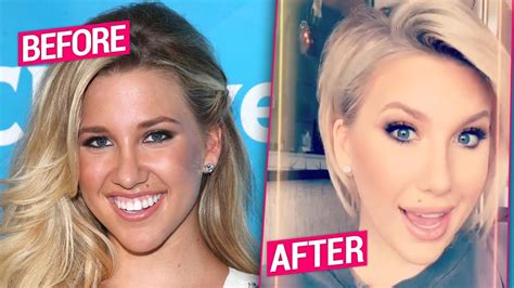 Savannah Chrisley Plastic Surgery Makeover Exposed