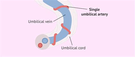 Anatomy Umbilical Cord Two Umbilical Veins One Umbilical, 53% OFF