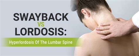 Swayback vs Lordosis: Hyperlordosis Of The Lumbar Spine