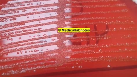 Citrobacter freundii: Introduction, Morphology, Pathogenicity, Lab