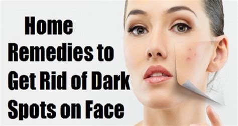 Health Tips 12: 7 NATURAL REMEDIES FOR DARK SPOTS