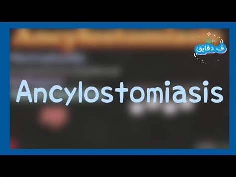 Ancylostomiasis: life cycle, clinical picture, diagnosis, treatment شرح ...