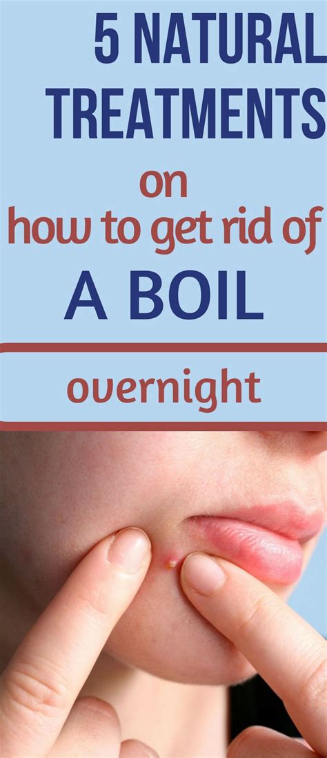 5 Natural Treatments on How To Get Rid of a Boil Overnight | How to get rid, Natural treatments ...