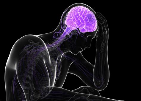 Overview of Elevated Intracranial Pressure