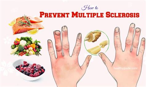 12 Tips How to Prevent Multiple Sclerosis Symptoms & Pain from Happening