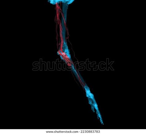 Brachial Arteries Arm Upper Extremity Bone Stock Illustration ...