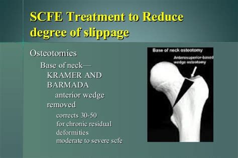 SLIPPED CAPITAL FEMORAL EPIPHYSIS - By Dr. Lokesh Sharoff