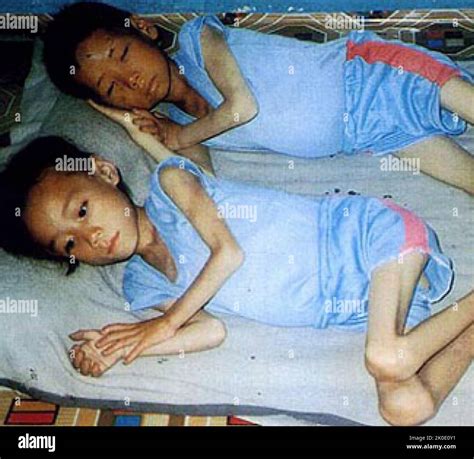 North korea famine children hi-res stock photography and images - Alamy