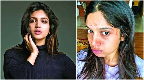 Bhumi Pednekar Before Surgery / Bhumi Pednekar Wikipedia / 1,050,385 likes · 56,504 talking ...