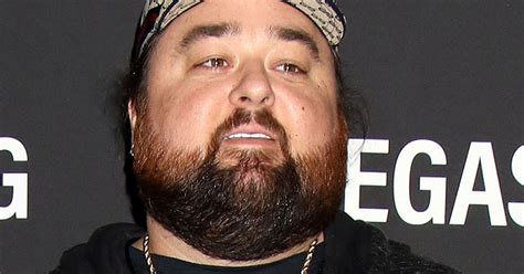 Chumlee Weight Loss Surgery | Blog Dandk