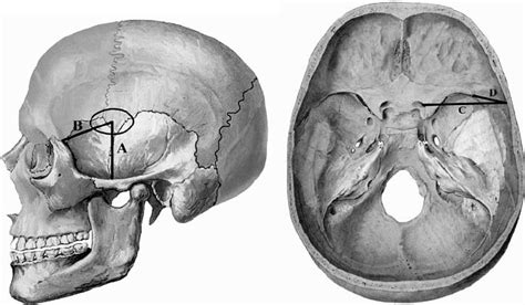 Measurements taken from each skull. A , vertical distance from the... | Download Scientific Diagram