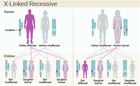 lesch nyhan syndrome life expectancy