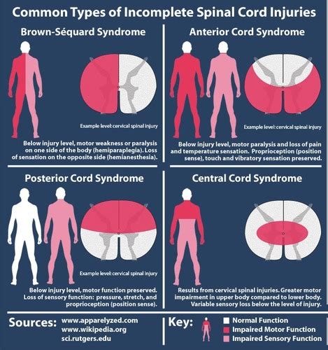 EMT Chapter 32- Spinal Column and Spinal Cord Trauma Flashcards | Quizlet